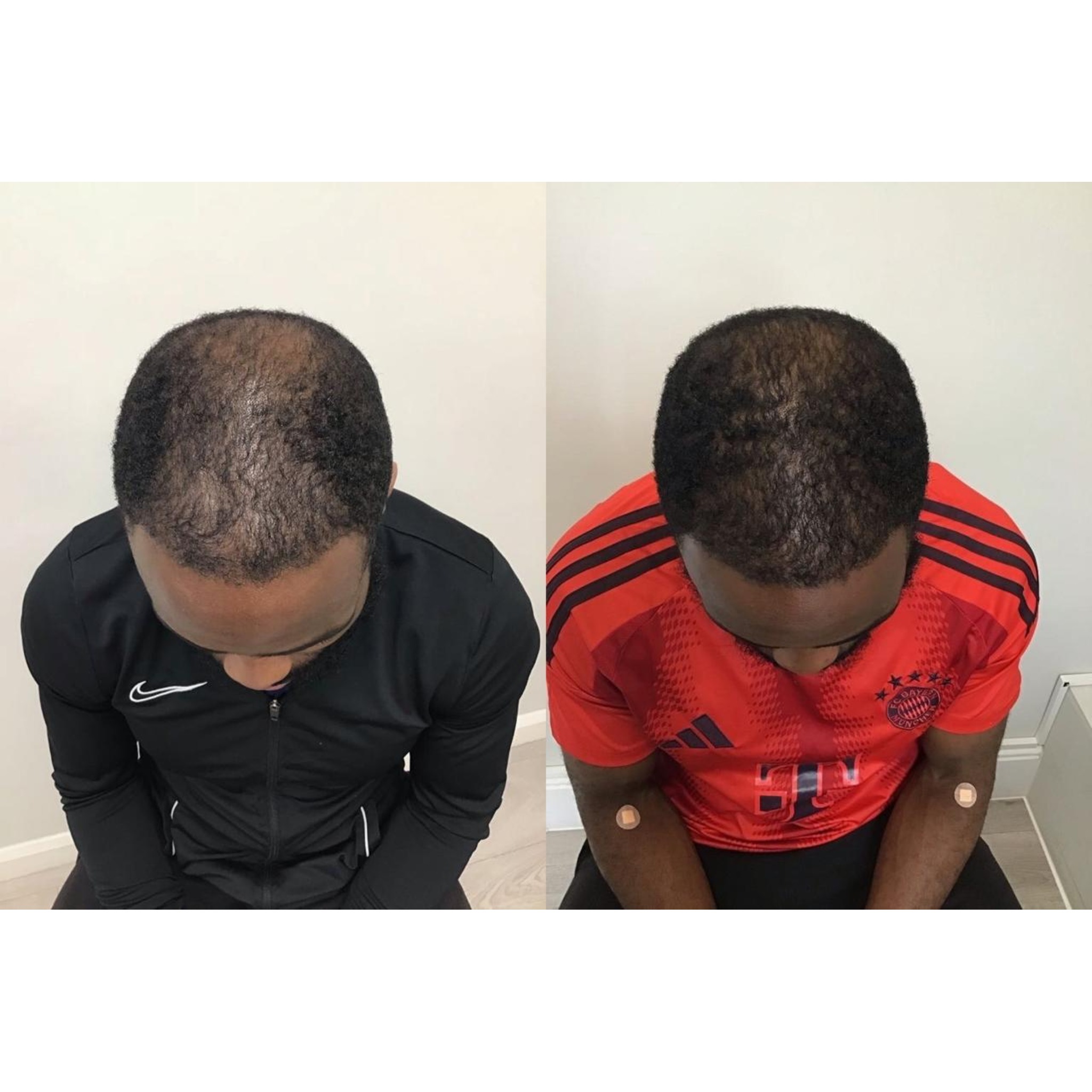 EsteAfroHairGrowth (1)